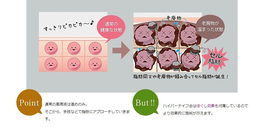 特殊ハンドピースが脂肪ケアするまでのメカニズム