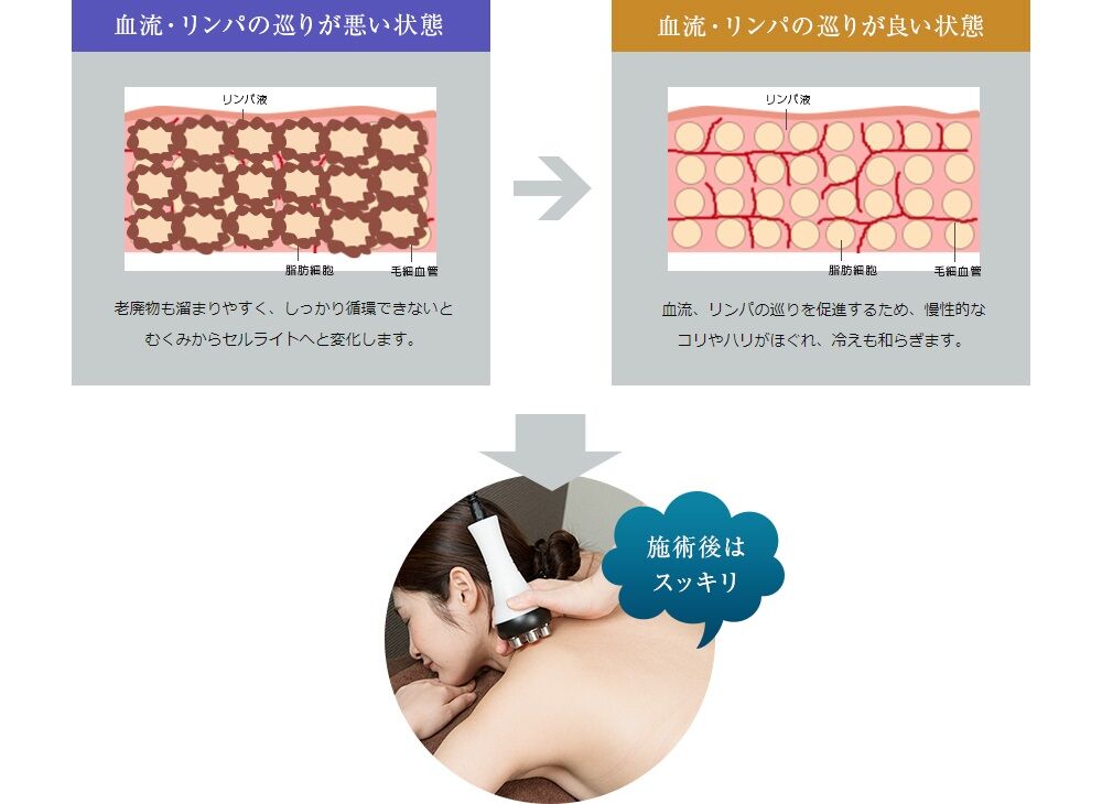 肩こり、腰痛、足のむくみやだるさの解消